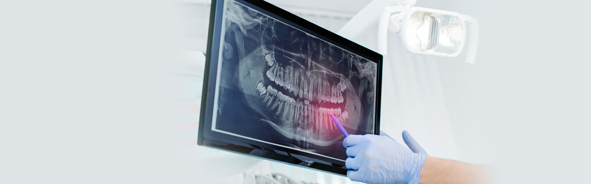Digital X-Rays in SW Portland, OR