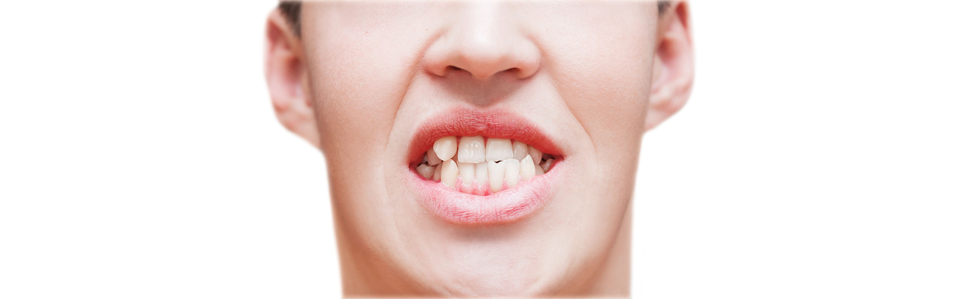 Clear Aligners: The Simple Solution for Misaligned and Crooked Teeth